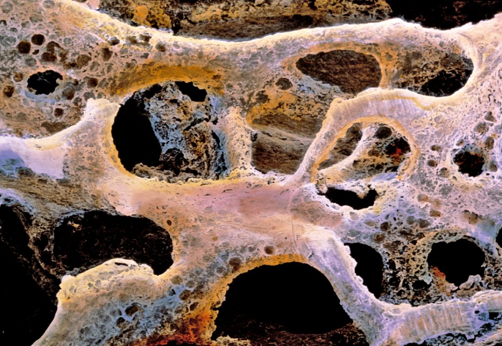 Altro che della dieta, l’osteoporosi è tutta colpa degli uomini neolitici
