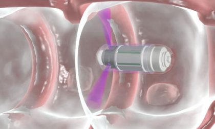 La pillola d'avanguardia ai raggi X che mapperà tutto il nostro corpo
