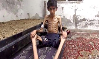 Siria, l'assedio e la fame di Madaya dove la gente mangia le foglie