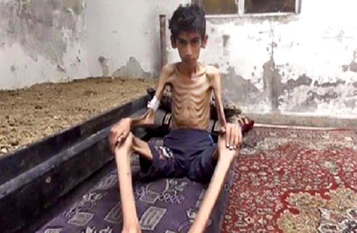 Siria, l’assedio e la fame di Madaya dove la gente mangia le foglie