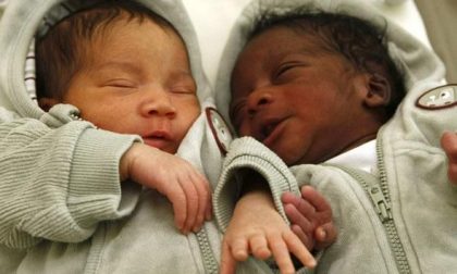 Lo strano caso dei due gemelli che sono nati da padri diversi