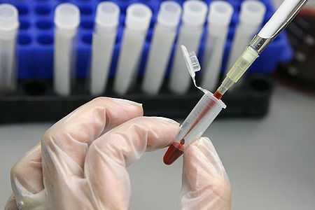 Sanità, finalmente una bella sorpresa: forte calo delle morti per tumore in Bergamasca