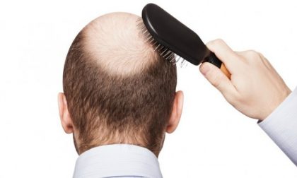 Perché perdiamo i capelli?