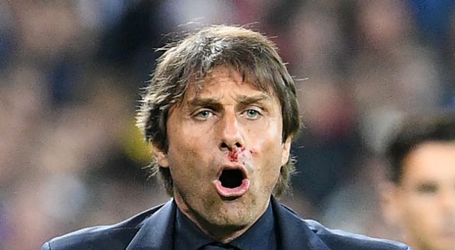 antonio-conte-ferito-italia-belgio