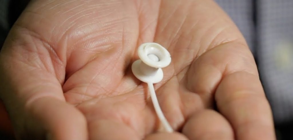 La voce per chi ha il cancro alla gola e altre 4 novità tecnologiche