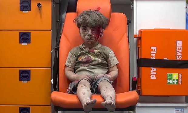 Come aiutare il bimbo di Aleppo (e le organizzazioni attive in Siria)