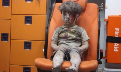 Come sta ora il bimbo di Aleppo