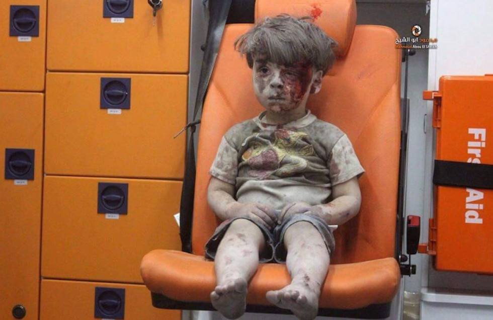 Come sta ora il bimbo di Aleppo