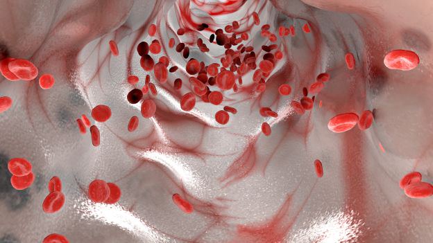 I nuovi vampiri della Silicon Valley Sangue giovane per non invecchiare