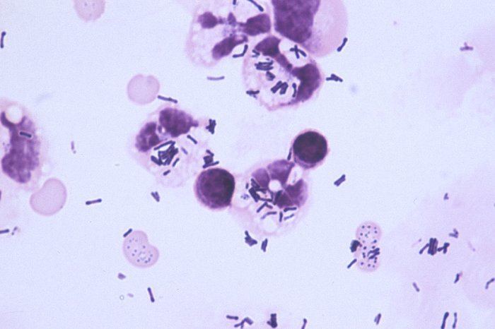 I formaggi vi danno allergia? Tranquilli, trovato il batterio buono