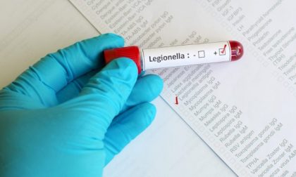 Allarme legionella in Brianza: morto un anziano. Dopo il Covid l’altro nemico dei polmoni
