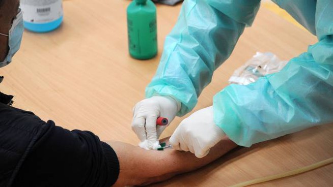 Test sierologici, le precisazioni di Ats e l’imbarazzante ritardo di Regione Lombardia