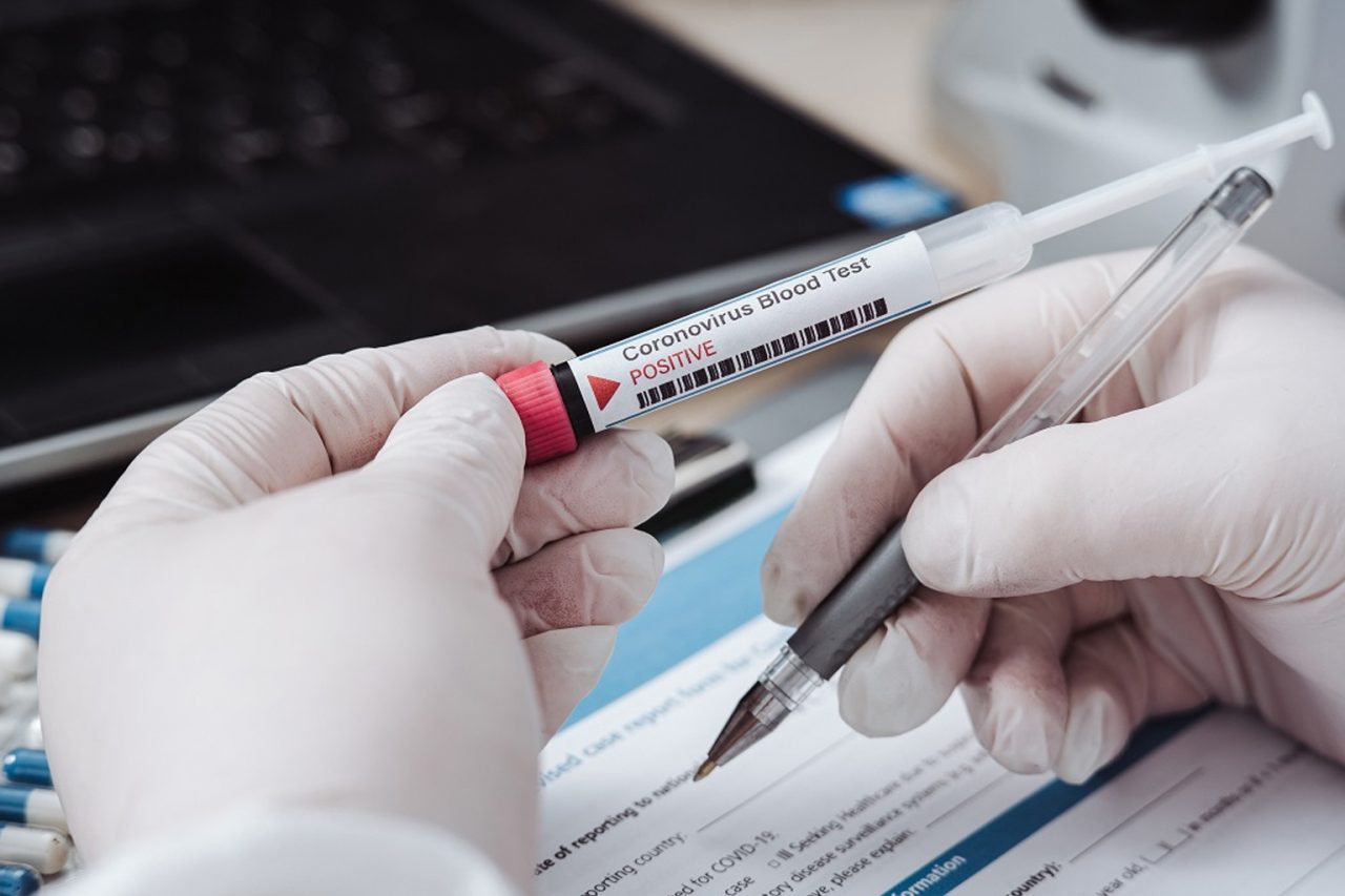 La Regione torna sui suoi passi: test sierologici a prezzi calmierati e tamponi gratuiti