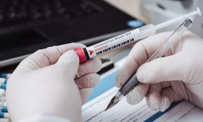 La Regione torna sui suoi passi: test sierologici a prezzi calmierati e tamponi gratuiti