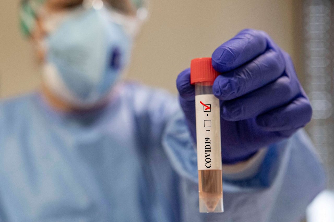 A Bergamo è circolato il ceppo di virus più veloce e aggressivo
