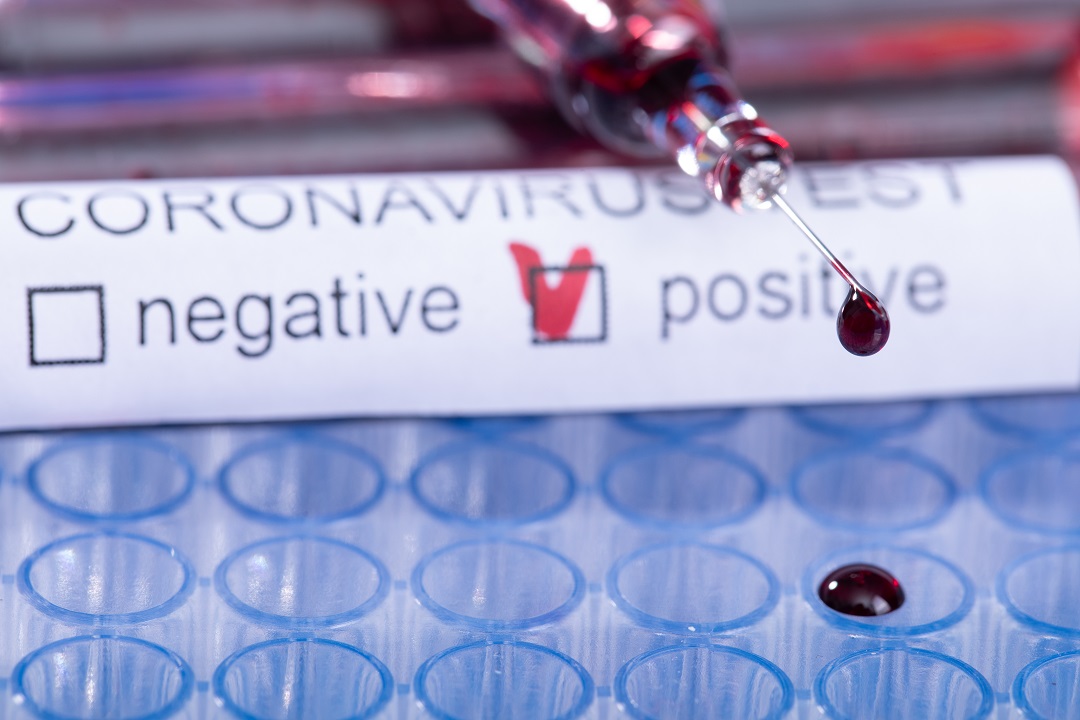 Per quanto tempo si resta immuni al Covid? Si cerca la risposta nei test sierologici
