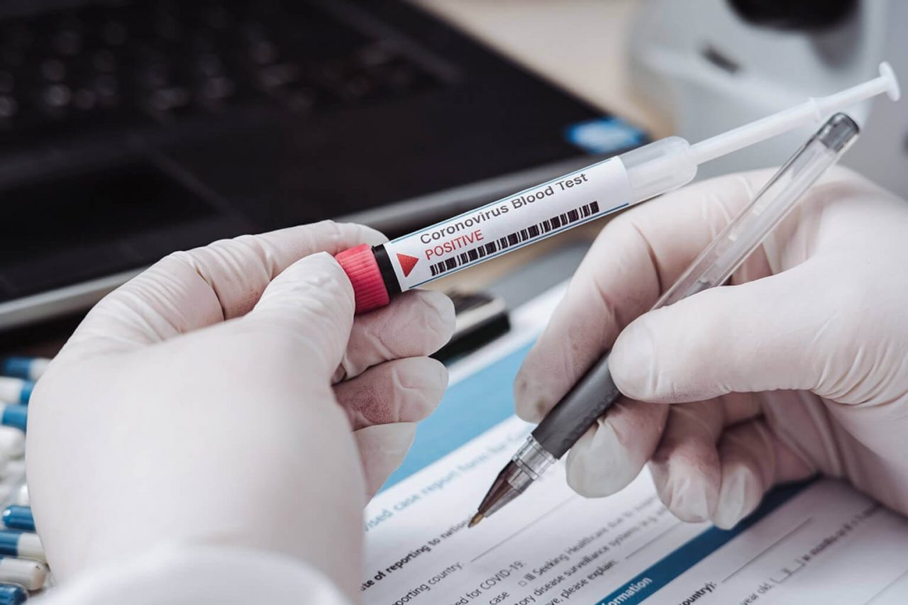 Tamponi rapidi, a disposizione i primi 4.548 per le strutture sociosanitarie bergamasche