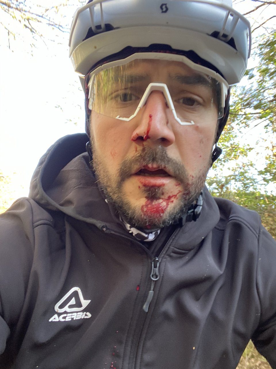 Ferito al volto da un filo spinato teso sui colli di Città Alta: il video e la rabbia di un ciclista