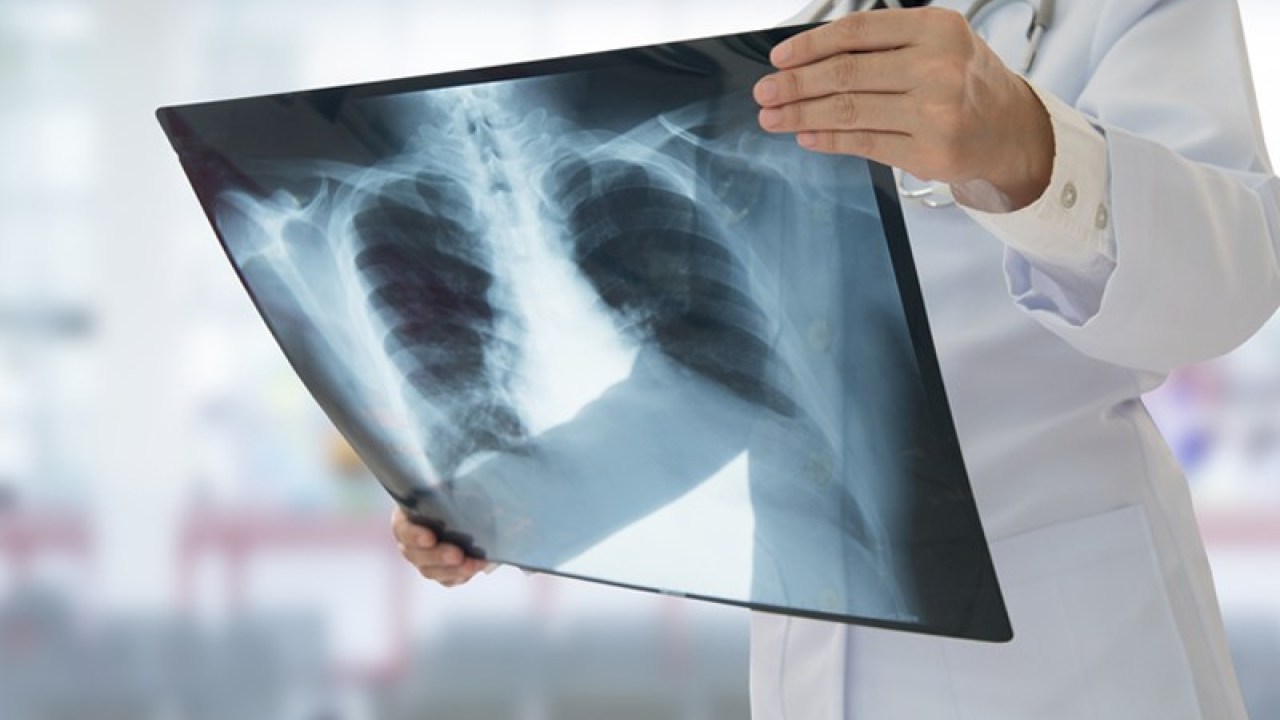 Radiografie a domicilio: ecco tutti i vantaggi