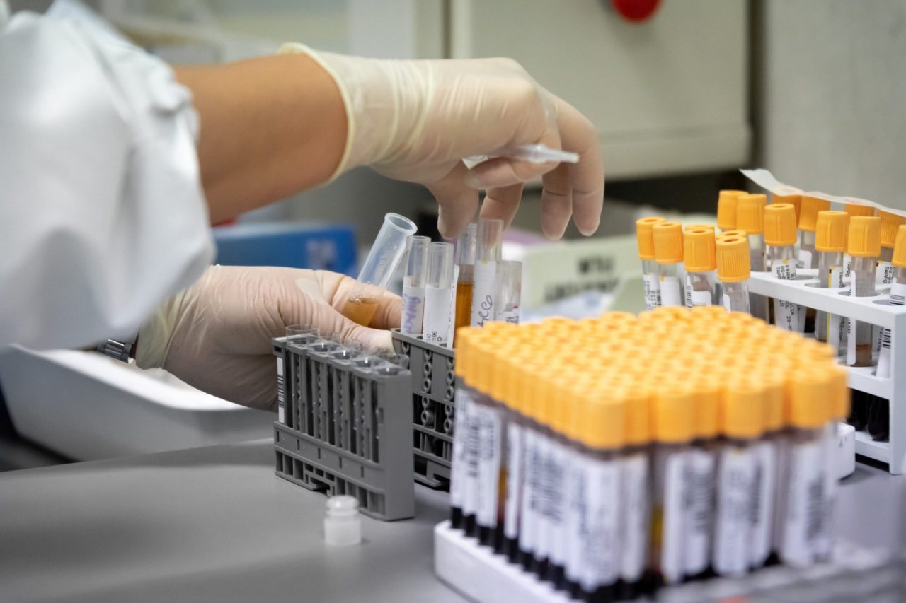 Lombardia, positivi al covid arrivati dalla Cina: per ora tutti Omicron