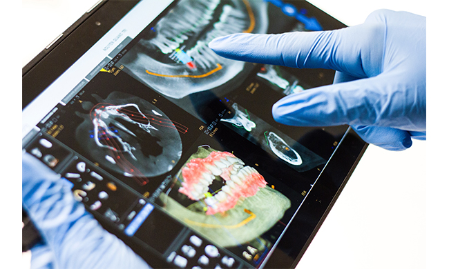 Perdita dei denti? L’implantologia guidata al computer per tornare a sorridere