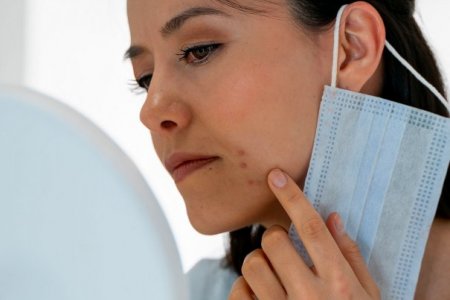 Consigli su come combattere i problemi alla pelle legati all’uso della mascherina