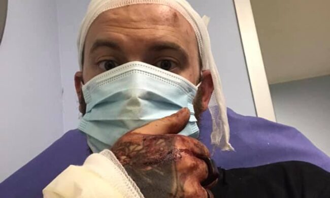 Barista brutalmente picchiato a sangue per aver richiamato due clienti ubriachi