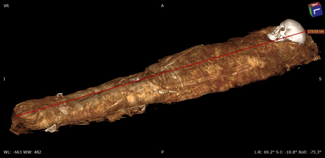 Tac e autopsia virtuale sulla mummia di Ankhekhonsu: aveva tra i 40 e i 50 anni