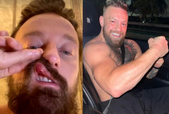 Roby Facchinetti sull’aggressione al figlio Francesco ad opera di McGregor: «Poteva ucciderlo»