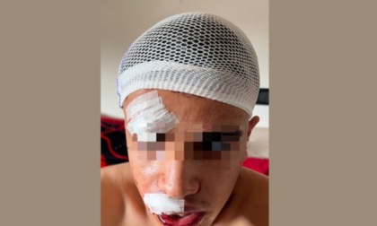 Un 22enne di Brignano picchiato da sei uomini con una mazza da cricket fuori dal Number One