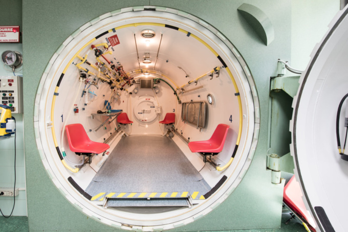 Si guasta la caldaia della cucina: giovane di 28 anni intossicata dal monossido di carbonio