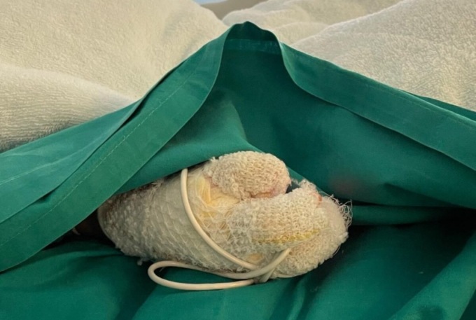 Bimbi ustionati all’asilo, il commovente racconto della mamma di Ale: «Non giudico, ma provo rabbia»