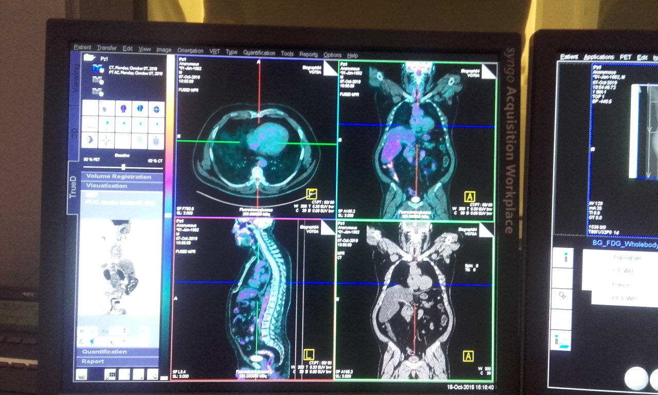 4b - imaging PET-TC monitor