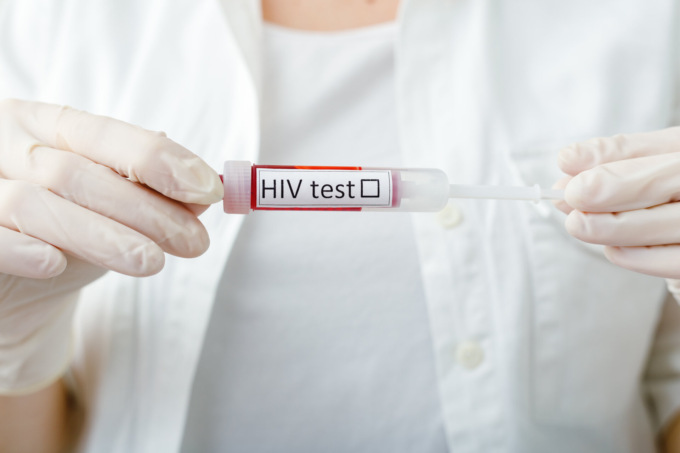 Settimana Europea del Test: anche a Bergamo prelievi gratuiti per Hiv, Hcv e Sifilide