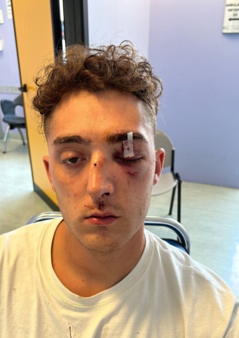 Sebastian, pestato selvaggiamente a Cologno. La madre: «C’era tanta gente, chi sa parli»