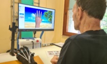 Riabilitazione robotica a Mozzo, un guanto aiuta a recuperare l'uso della mano