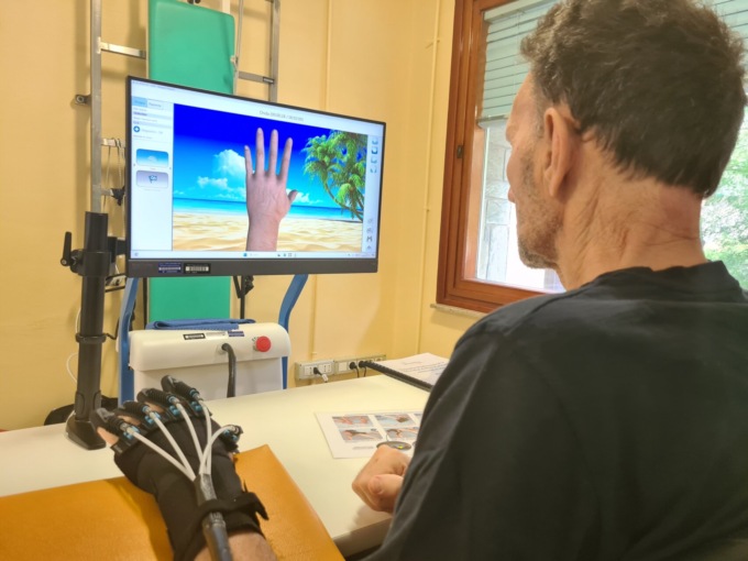 Riabilitazione robotica a Mozzo, un guanto aiuta a recuperare l’uso della mano