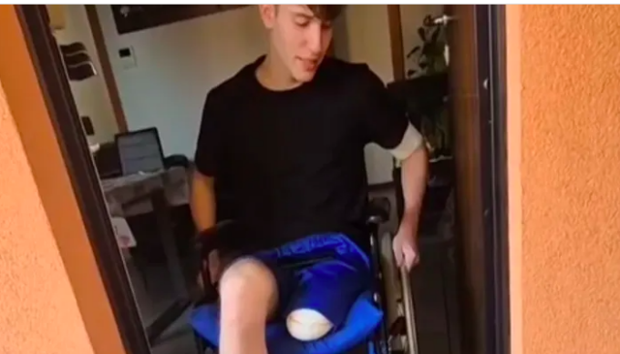Manuel, 22 anni di Bergamo, ha bisogno di una protesi e avvia una raccolta fondi