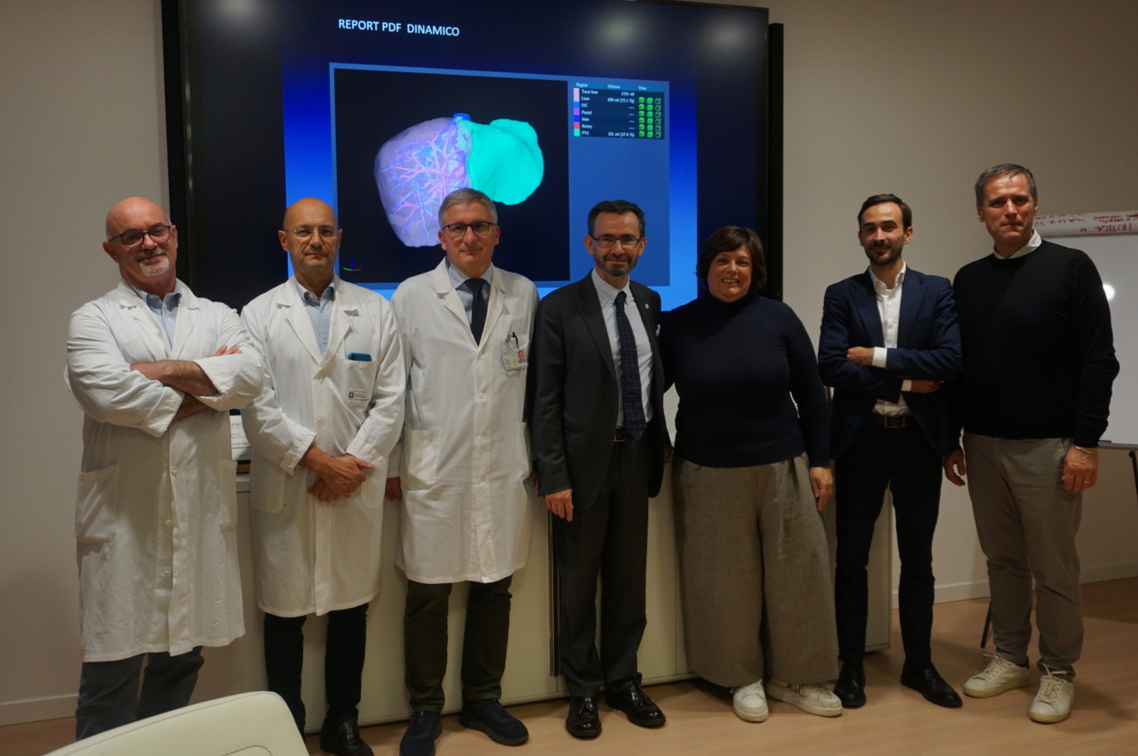 Donato alla chirurgia pediatrica del Papa Giovanni il software “Synapse”, per migliorare i risultati delle operazioni