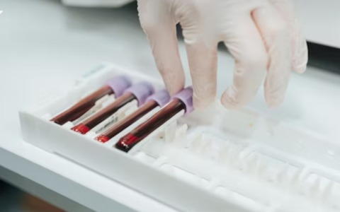 Synlab riapre a Seriate: torna operativo il punto prelievi di via Nazionale. Già 15 centri in Bergamasca, presto altre due aperture