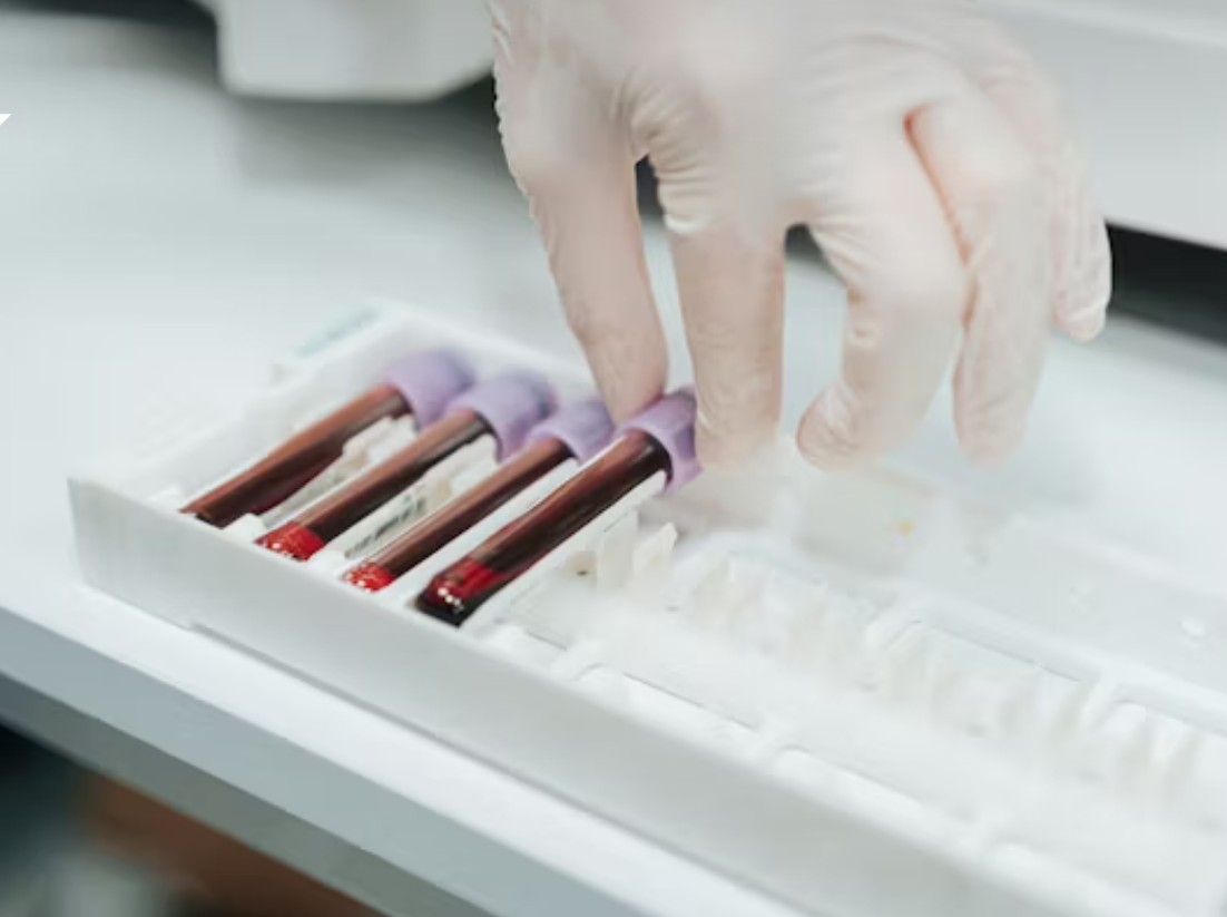 Synlab riapre a Seriate: torna operativo il punto prelievi di via Nazionale. Già 15 centri in Bergamasca, presto altre due aperture