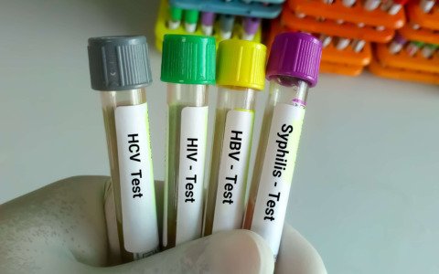 Arrivano a Bergamo (in via Madonna del Campi) i test rapidi per le malattie sessualmente trasmissibili