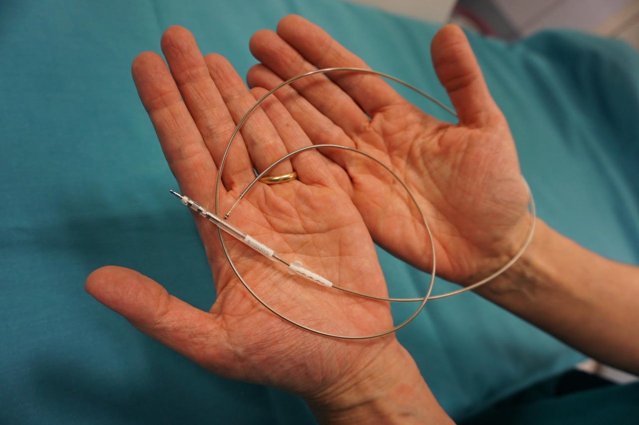 All’ospedale Papa Giovanni impiantato l’elettrocatetere transvenoso da defibrillazione più piccolo al mondo