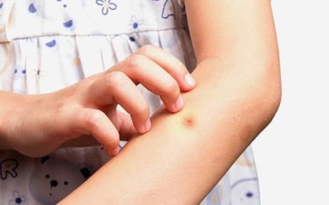 Caldo, zecche e meduse: le regole d’oro per proteggere i bambini in vacanza